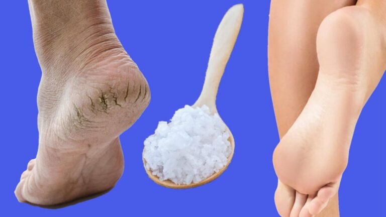Cette astuce simple transforme des talons fendillés en douceur bébé en quelques minutes…