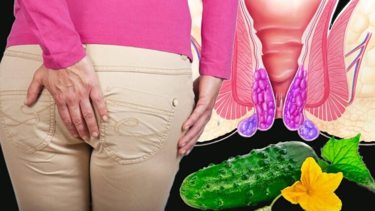 Cette astuce méconnue soulage les hémorroïdes en un jour… Découvrez comment !