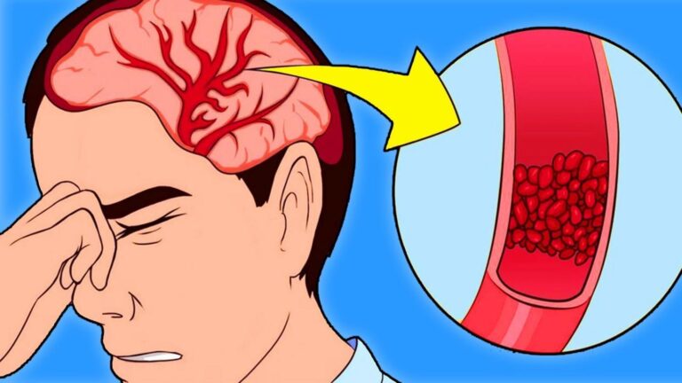 Beaucoup ignorent que ces signes indiquent un hypertension… Découvrez-les et agissez vite!
