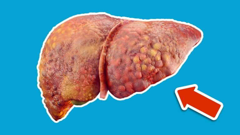 Évite ces 3 erreurs qui nuisent à ta santé hépatique et améliore ton bien-être !
