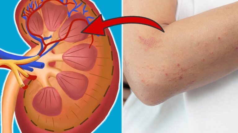 7 Signes que tes reins ont besoin d&rsquo;aide : découvre-les pour ta santé !