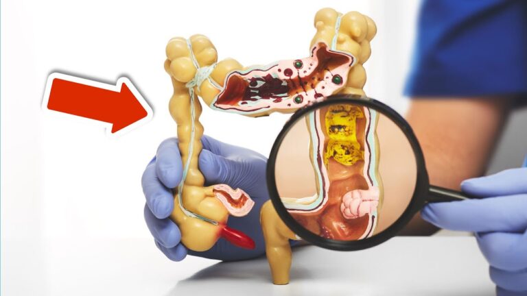 5 conseils pour garder un intestin en pleine santé et boostez votre bien-être !